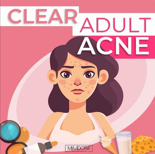 How to Clear Adult Acne (without meds)